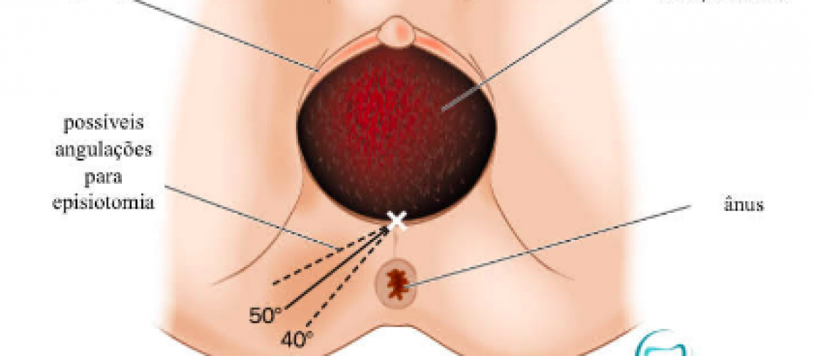 A passagem da cabeça do bebê pelo canal do parto causa estiramento dos órgãos aos redor da vagina, necessitando cuidados adicionais para que não ocorram lesões nesse local